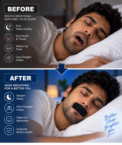 Premium Sleep Tape – Mouth Tape Patch (30 Pcs | 1 Month Supply)